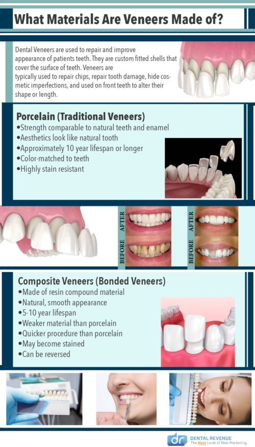 Porcelain Veneers Acton MA | Dr. Ratti Handa, DDS