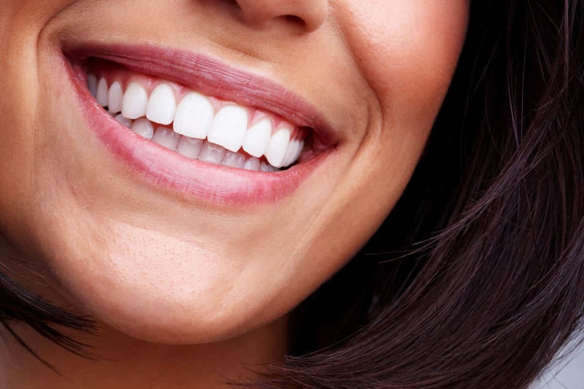 Patient smiling after dental veneers treatment at Prana Integrative Dental Wellness